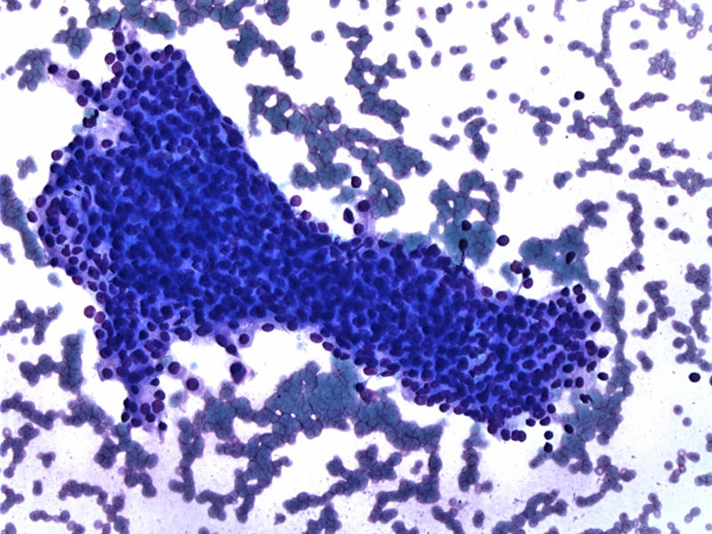 Pathology Image